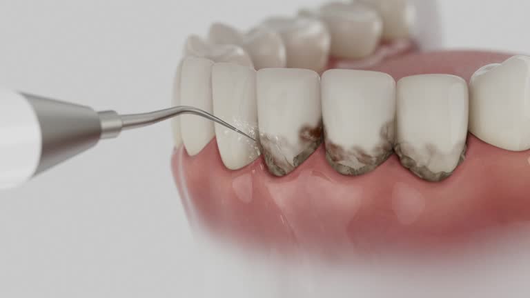 Trusted Root Canal Treatment service in Dunmore, PA - Dentist Open Now